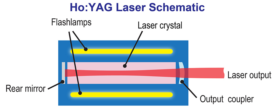 Ytterbium (Yb)-Laser für die optogenetische 2-Photonen-Photostimulation