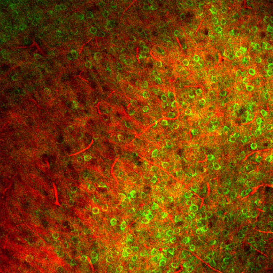3-Photonen-Bildgebung des primären visuellen Kortex einer Maus durch dicht markiertes Gewebe. Das grüne Signal entspricht der Expression von GCaMP6f; der rote Kanal zeigt das Signal der dritten Harmonischen, das sowohl von der weißen Substanz als auch vom Gefäßsystem erzeugt wird. Die Anregung erfolgte mitMonaco Coherent Monaco bei 1300 nm. Bild mit freundlicher Genehmigung von J. Reimer und A. Tolias (Baylor College of Medicine) sowie T. Wang, D. Ouzounov und C. Xu (Cornell)