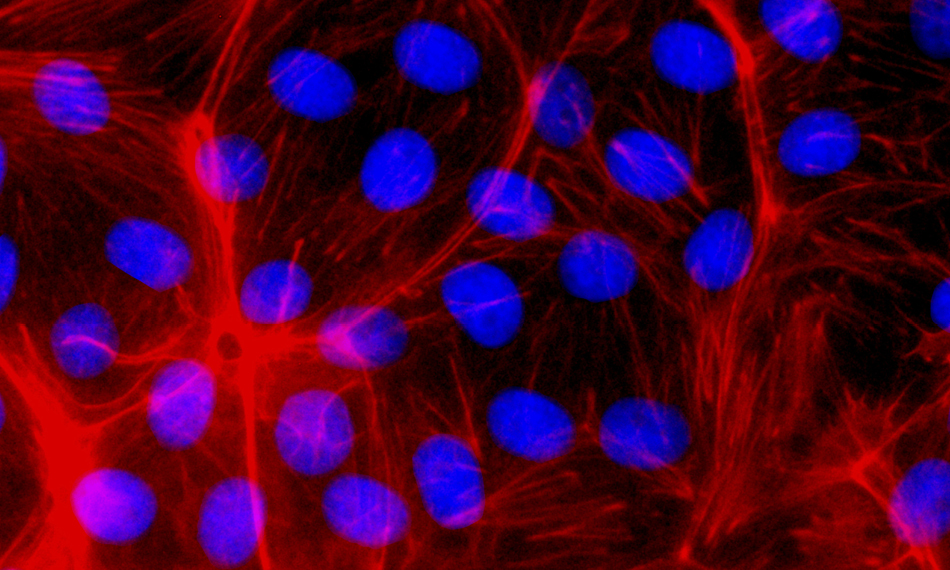 Aktuelle UV-Fluoreszenzfarben